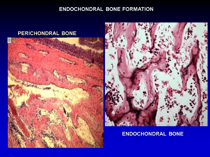 ENDOCHONDRAL BONE FORMATION  PERICHONDRAL BONE ENDOCHONDRAL BONE